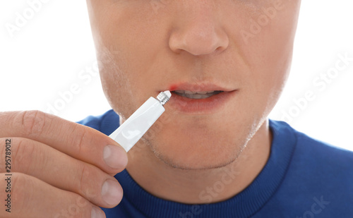 Man with cold sore applying cream on lips against white background  closeup