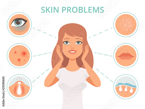 Skin problems. Beauty woman scrub care face infection darkness scrubs oily face cleanse vector symbols. Illustration skin dermatology problem, face beauty and care