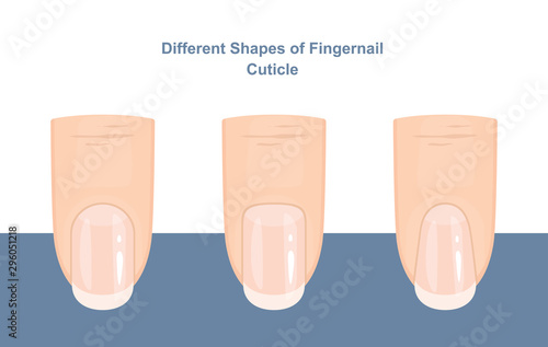 Different Shapes of Fingernail Cuticles. Manicure Guide. Vector illustration
