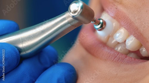 process of teeth polish close up
