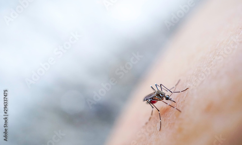 Mosquito sucking blood on human skin Malaria,Dengue,Chikungunya,Zica virus