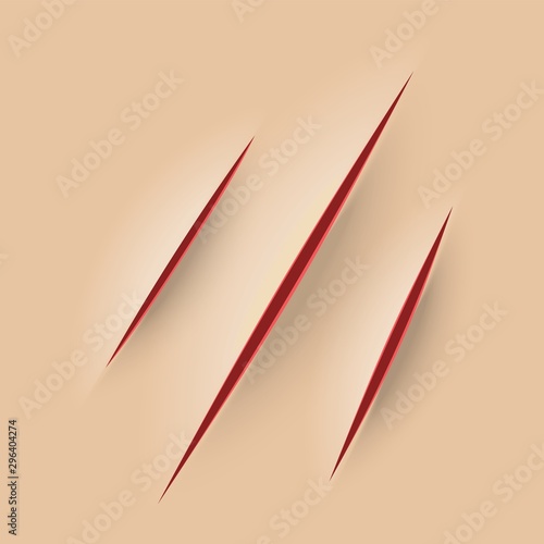 Scratch on skin. Red blood. Razor cut vector illustration. Realistic vector gash effect