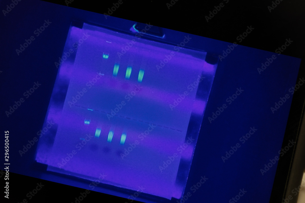 Polymerase Chain Reaction (PCR) and Agarose gel electrophoresis is a ...