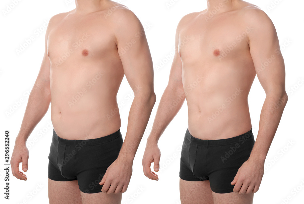 Fototapeta premium Man before and after plastic surgery on white background