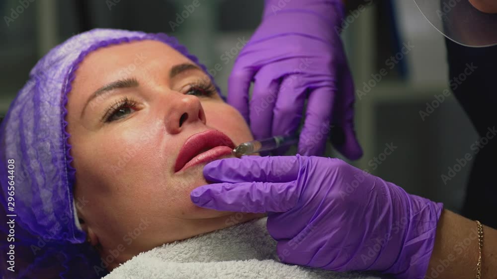 Lip injection plastic surgery. Process of lip augmentation. Patient