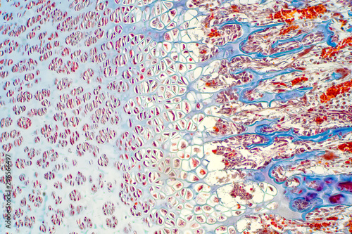 Φωτογραφία Cartilage is a resilient and smooth elastic tissue for pathology education