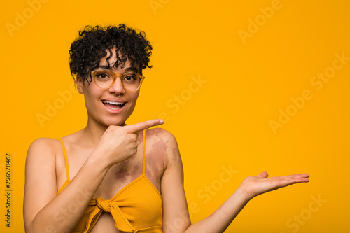 Young african american woman with skin birth mark excited holding a copy space on palm.