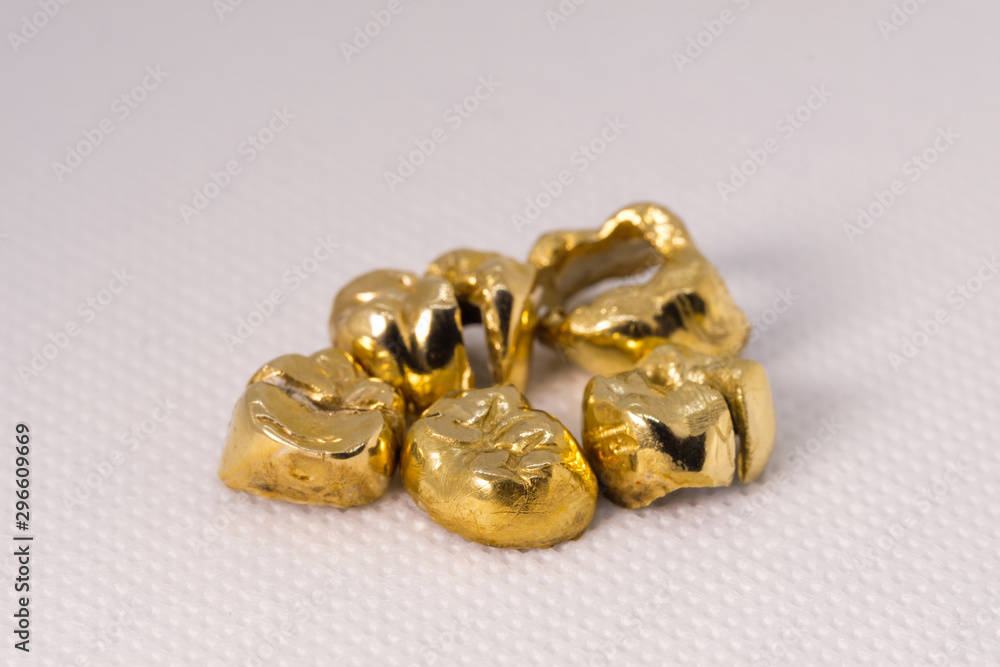 Zahngold / Altgold / Goldkronen Zahngold / Altgold / Goldkronen