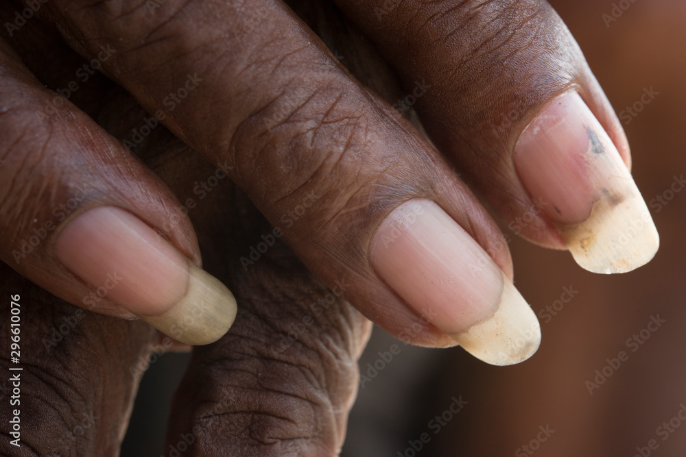Rio de Janeiro, Brazil - March 24, 2016: Old man long nails detail