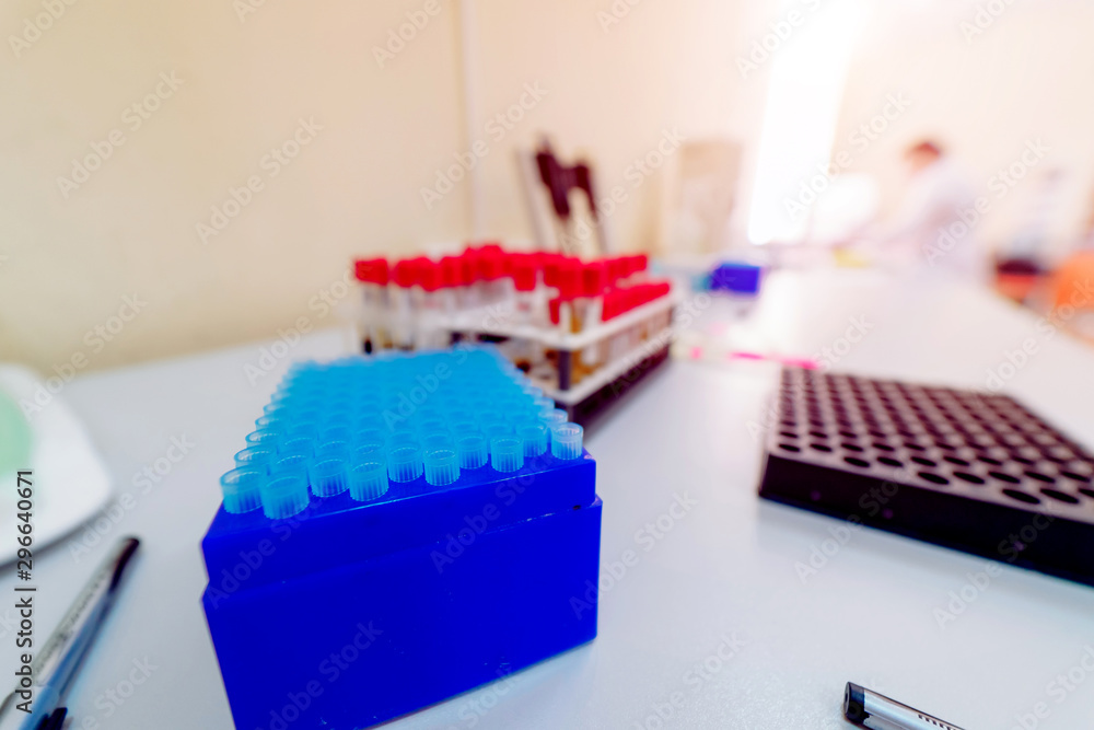 Blood test tubes. Blood samples in a rack. Closeup.