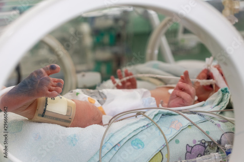 Incubator with a sick newborn baby at neonatal intensive care unit. feet with ink from footprint