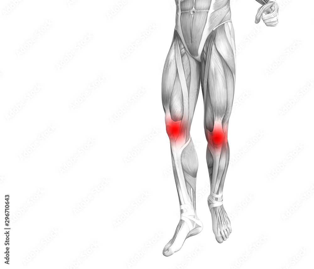 Conceptual knee human anatomy with red hot spot inflammation or articular joint pain for leg health care therapy or sport muscle concepts. 3D illustration man arthritis or bone osteoporosis disease Conceptual knee human anatomy with red hot spot inflammation or articular joint pain for leg health care therapy or sport muscle concepts. 3D illustration man arthritis or bone osteoporosis disease