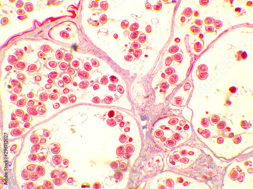 Obraz na plátně Hydatid cyst under the microscope (100x)