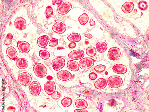 Echinococcal cyst under the microscope (400x). Echinococcus granulosus. Dog tapeworm parasite. photo