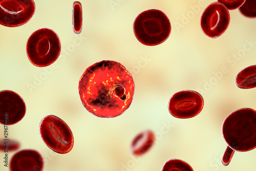 The malaria-infected red blood cell. 3D illustration showing parasite Plasmodium malariae in the stage of ring-form trophozoite