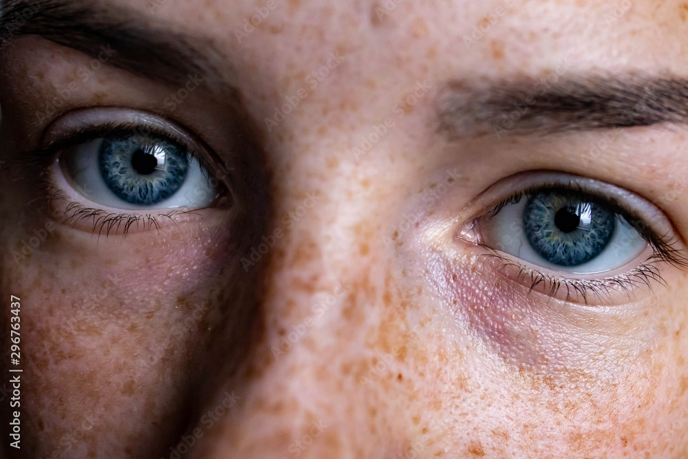 Face of a girl with freckles. Blue eyes of a girl close-up Face of a girl with freckles. Blue eyes of a girl close-up