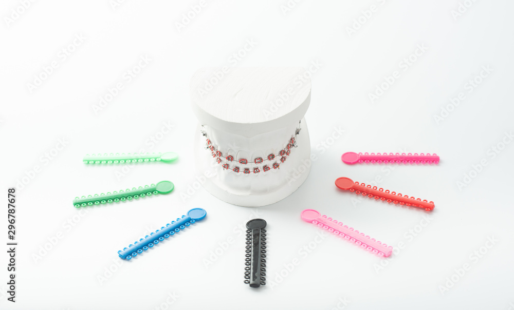 Dental braces model with colorful elastic o-ring. Dental braces model with colorful elastic o-ring.