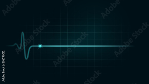 Pulse rate Line while dead on green chart background of monitor. Illustration about heart failure and Cardiogram monitor.