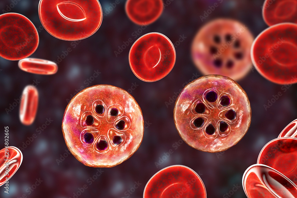 Infected Rbc The malaria-infected red blood cell. 3D illustration showing parasite ...