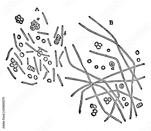 Bacillis Anthracis vintage illustration