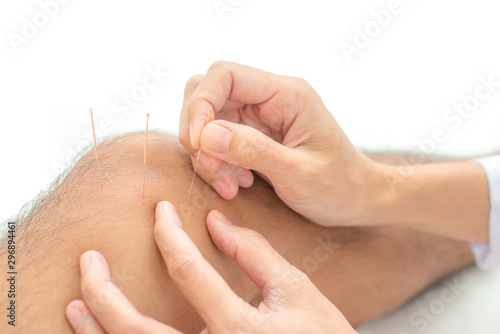 Closeup of hand performing acupuncture therapy young Asian man's knee