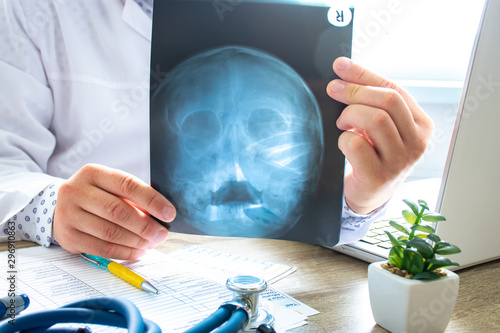 Doctor examines x-ray scan of head and skull near computer during work and patient advice in office. Diagnostics of diseases of ear, nose and throat, adenoids, abnormalities of skull, brain, bones photo