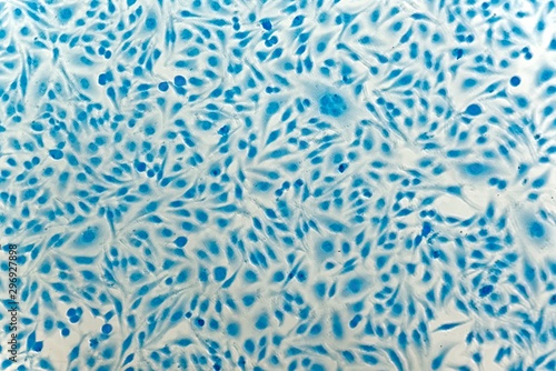 HeLa cervical cancer cells