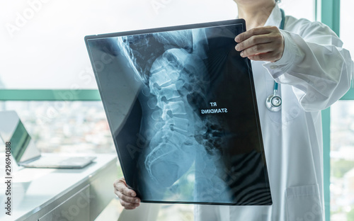 Photo Surgical doctor looking at radiological spinal x-ray film for medical diagnosis