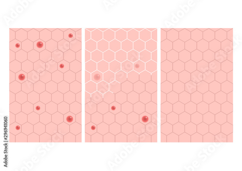lotion make skin better vector / acne and rash concept