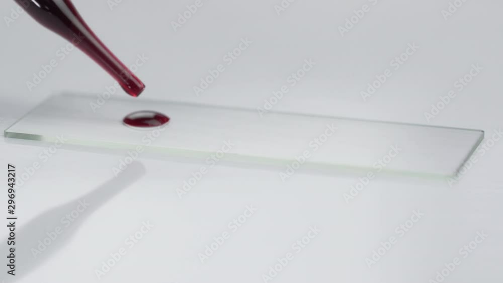 Dropping blood from a pipette onto slide glasses for testing. Scientific and healthcare research concept Dropping blood from a pipette onto slide glasses for testing. Scientific and healthcare research concept