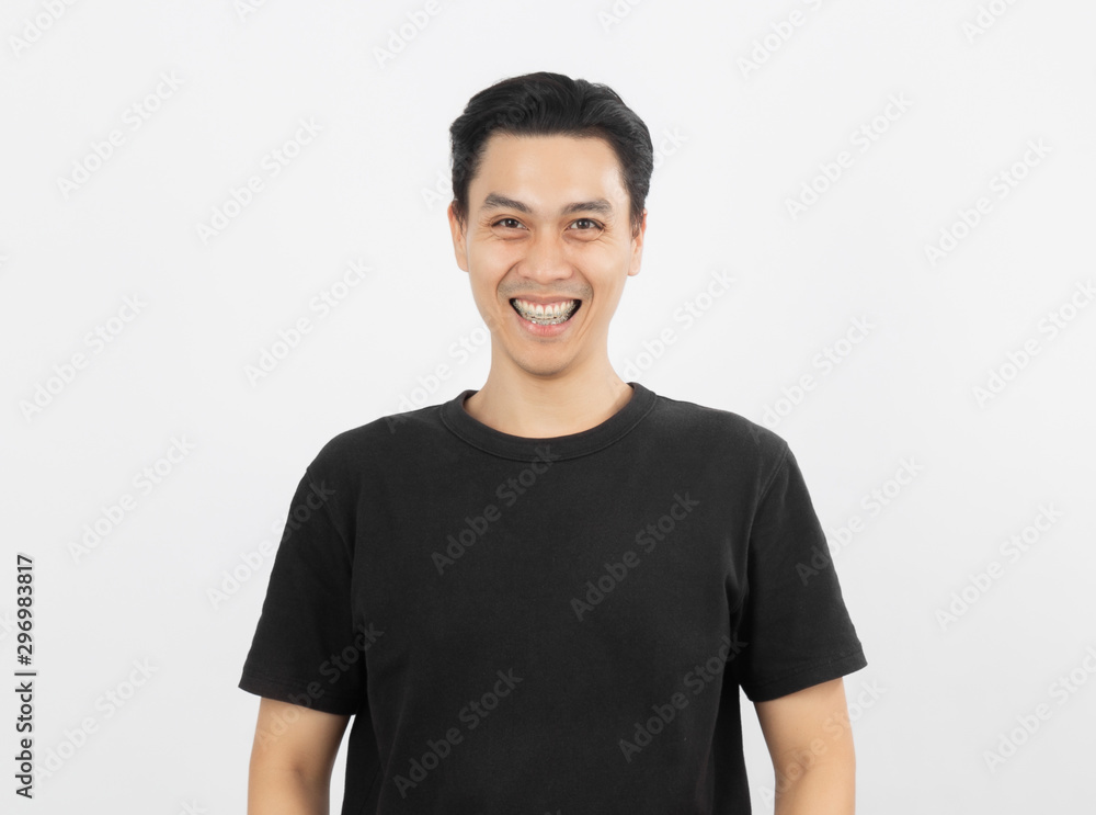 Young handsome asian man smiling with braces and looking at camera isolated on white background. Young handsome asian man smiling with braces and looking at camera isolated on white background.