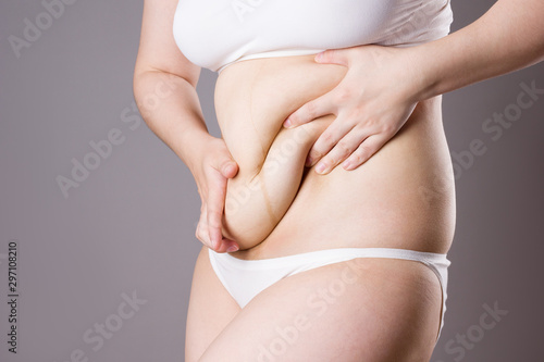 Wallpaper Mural Pregnancy line - linea nigra, tummy tuck, overweight female body and flabby belly on gray background Torontodigital.ca