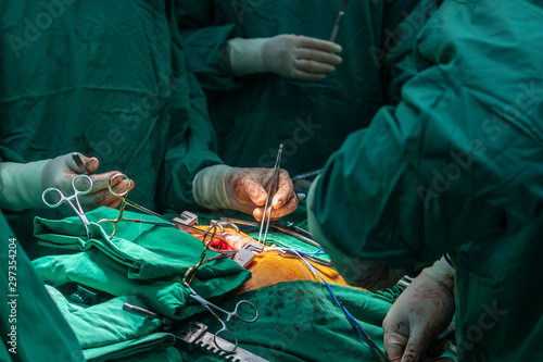 Photography Close up group of surgeons in Surgery operating room