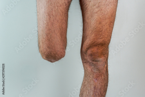 rugged man with an amputated leg isolated on White background
