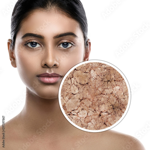 Indian woman and zoomed sample of her skin. Concept of different skin problems, itchy and dry.