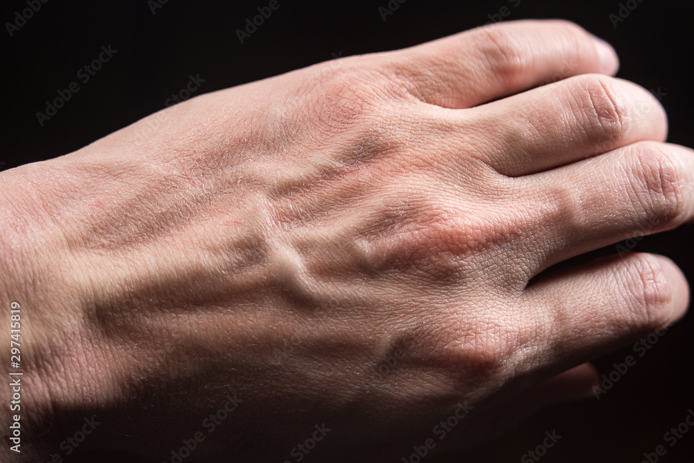 Fototapeta premium dry skin close-up on a black background, allergy, skin peeling, moisturizing