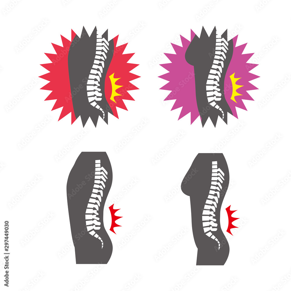 腰痛 男性 女性 ぎっくり腰 背骨 シルエット セット イラスト Stock Vector Adobe Stock