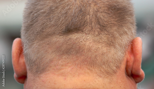 Konstfotografi Nape and ears of a fat man