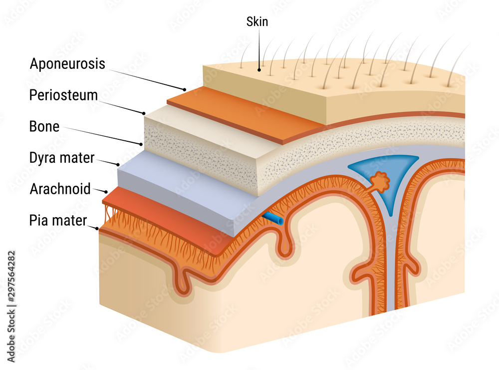 Inflammation of the meninges - meningitis. Bacterial inflammation of ...
