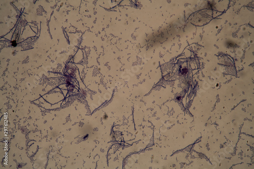St  bchenf  rmige Bakterien  unter dem Mikroskop 400x