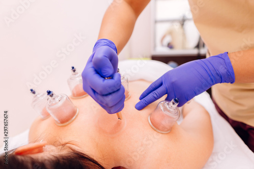 Slika na platnu Healing bloodletting, hijama or phlebotomy