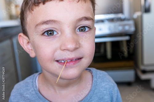 Boy has a stuck toothpick in his teeth