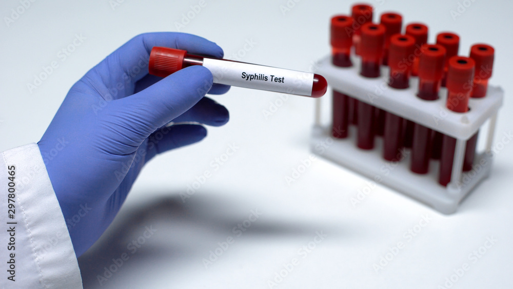 Syphilis test, doctor showing blood sample in tube, lab research, health checkup Stock Photo