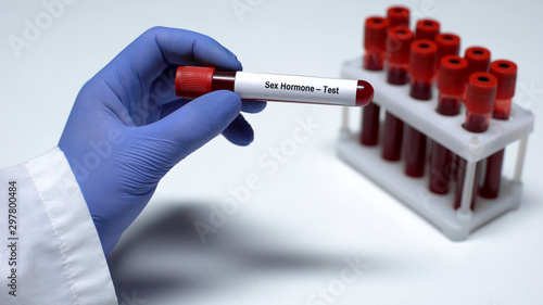 Φωτογραφία Sex Hormone, doctor showing blood sample in tube, lab research, health checkup