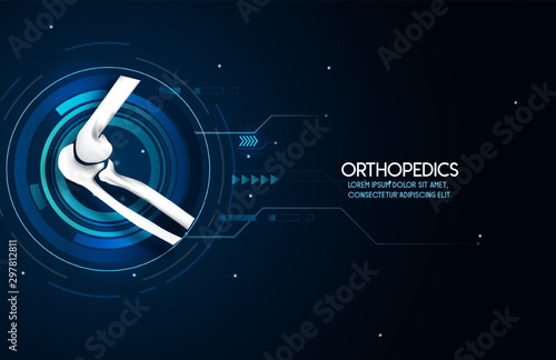 Medical orthopedic abstract background. Treatment for orthopedics traumatology of elbow bones and joints injury. Medical presentation, hospital. Vector illustration