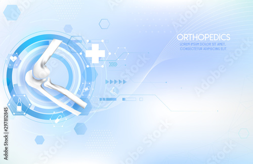 Medical orthopedic abstract background. Treatment for orthopedics traumatology of elbow bones and joints injury. Medical presentation, hospital. Vector illustration