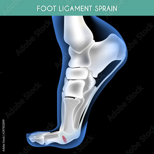 Medical orthopedic abstract background. Treatment for orthopedics traumatology of foot bones and joints injury. Medical presentation, hospital. Vector illustration