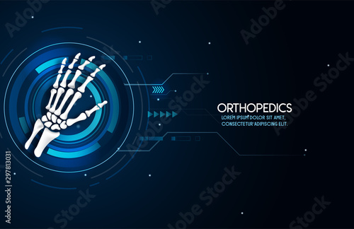 Medical orthopedic abstract background. Treatment for orthopedics traumatology of hand bones and joints injury. Medical presentation, hospital. Vector illustration