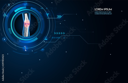 Medical orthopedic abstract background. Treatment for orthopedics traumatology of knee bones and joints injury. Medical presentation, hospital. Vector illustration photo