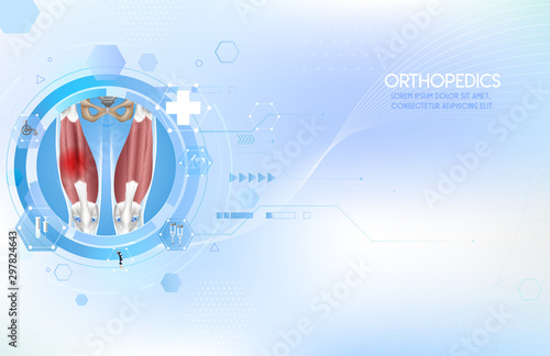  Medical orthopedic abstract. Treatment for orthopedics traumatology of knee bones and quadriceps muscle joints injury. Medical presentation, hospital. Vector Illustration